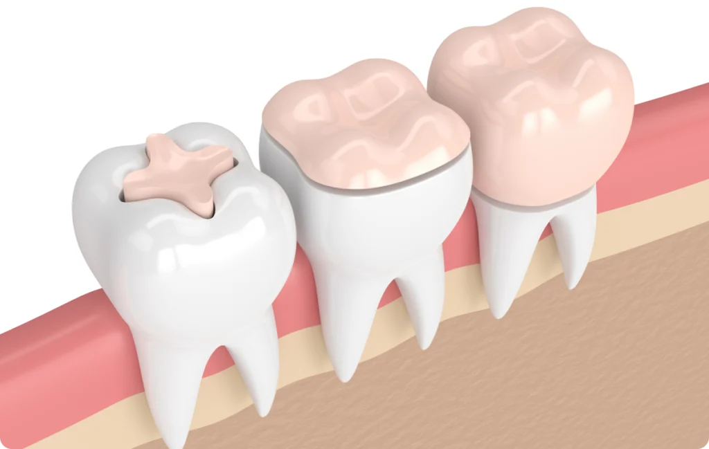 ilnay onlay mulhouse chirurgien dentiste x Omnipratique WP2 Template