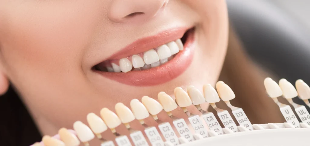 facettes dentaires x Omnipratique WP2 Template